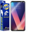 [2 Pack] LG V30 Case-Friendly Screen Protector Cheap